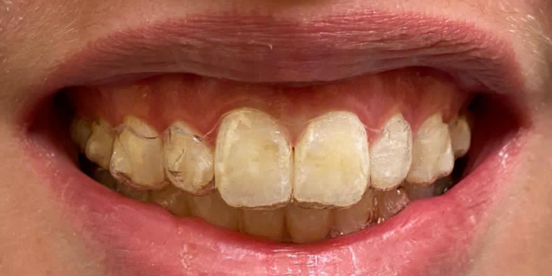 Dr Hiteshkumar Devani