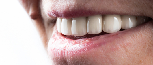 Dr Hiteshkumar Devani