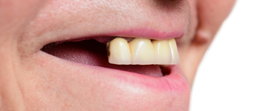 Dr Hiteshkumar Devani