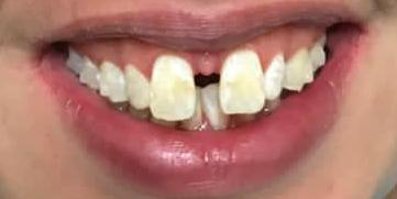 Dr Hiteshkumar Devani